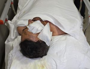 Silopi’ deki saldırıda yaralananlara transfer eziyeti!