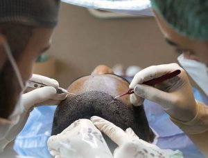 Sağlık Bakanlığı’ndan saç ekimi birimlerinde yeni dönem